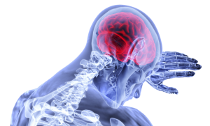 Common Signs of Whiplash or Traumatic Brain Injury