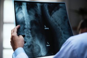 Herniated Disc and Other Spinal Injuries Caused by Car Accidents